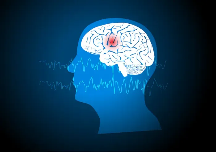 What is Epilepsy Causes, Symptoms, and Modern Treatments